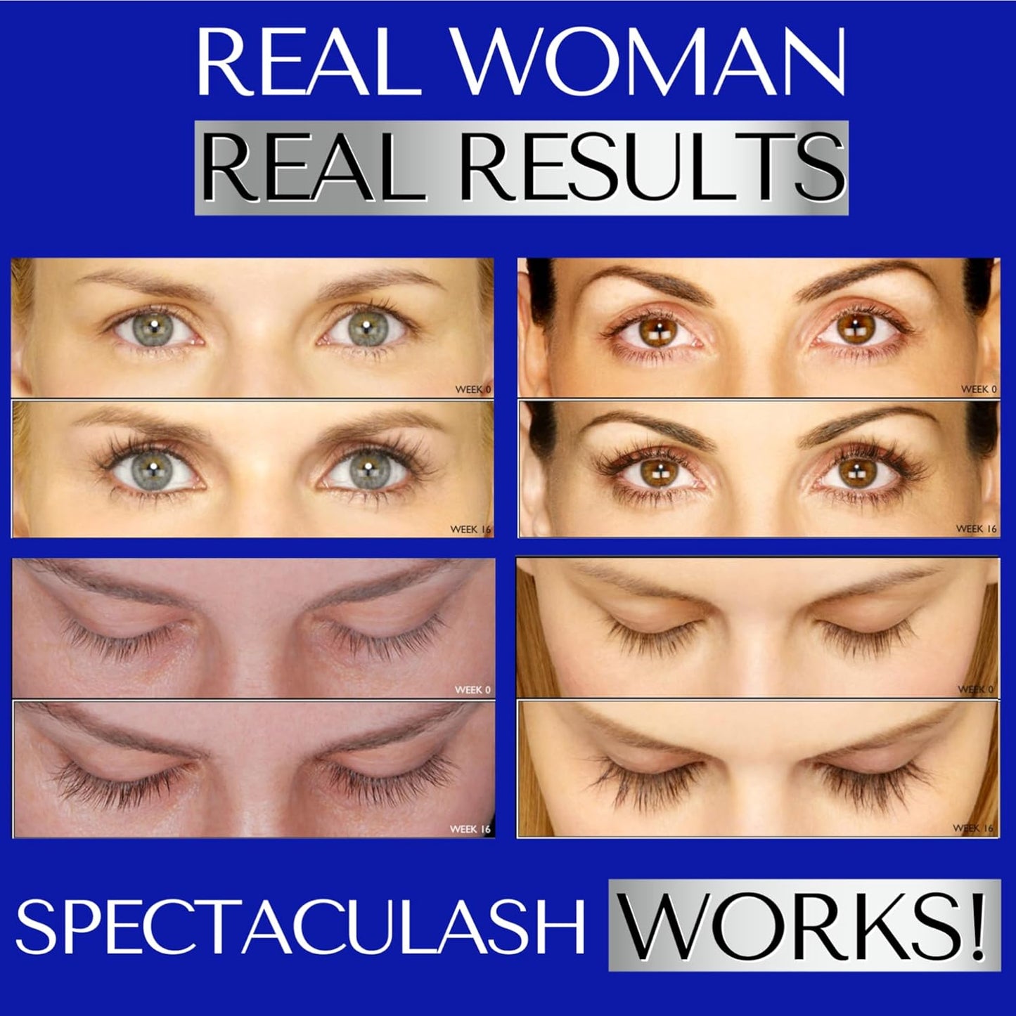 Lash Serum for Eyelash Growth - Eyelash Serum Growth - Eyelash Growth Serum - Eye Lash Serum Growth - Lash Growth Serum - Eyelash Enhancing Serum - Suero Para Pestañas Crecimiento (XL)